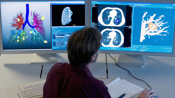 Computerunterstützte Analyse der Lunge basierend auf CT-Bilddaten