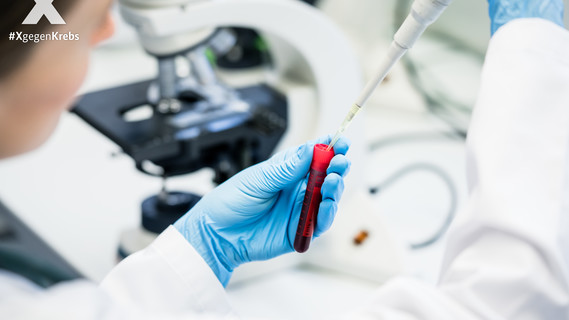 Arzt oder Laborant füllt Lösung in Bluttest im Labor