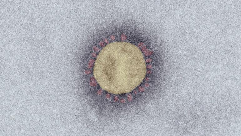 Das neue SARS-Coronavirus-2 unter dem Elektronenmikroskop (Maßstab: 100nm).