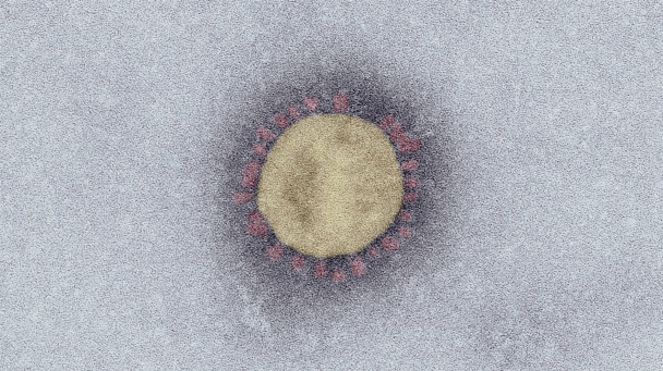 SARS-Coronavirus-2 (SARS-CoV-2, Isolat SARS-CoV-2/Italy-INMI1). Elektronenmikroskopie, Negativkontrastierung (PTA). Maßstab: 100 nm.